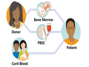 Allogeneic Bone Marrow Transplant
