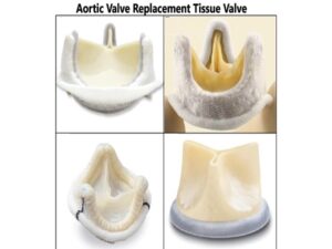 Aortic Valve Replacement Tissue Valve (2)