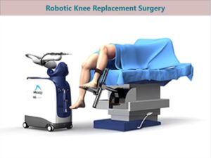 Robotic Knee Replacement Surgery Cost in India